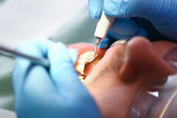 Best Emergency Root Canal Therapy in Land O Lakes, FL